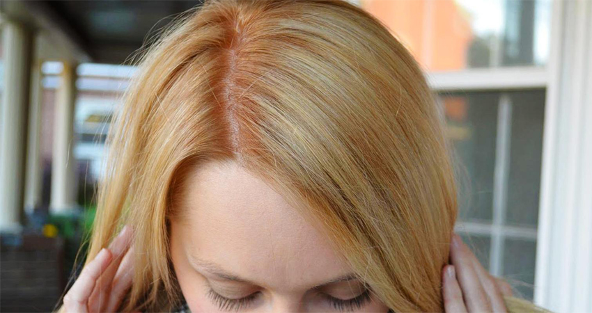 علت روشن شدن رنگ ریشه مو نسبت به ساقه